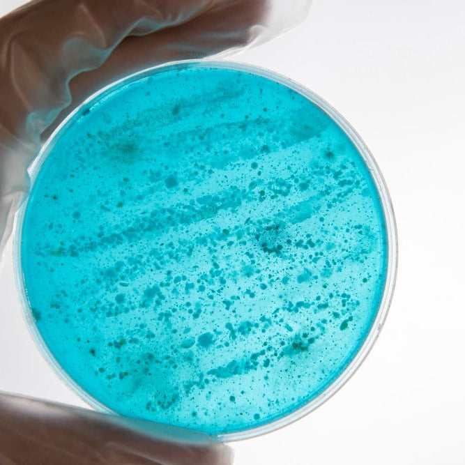 ¿Cómo se Contagia la Legionella? - Remi Hogar